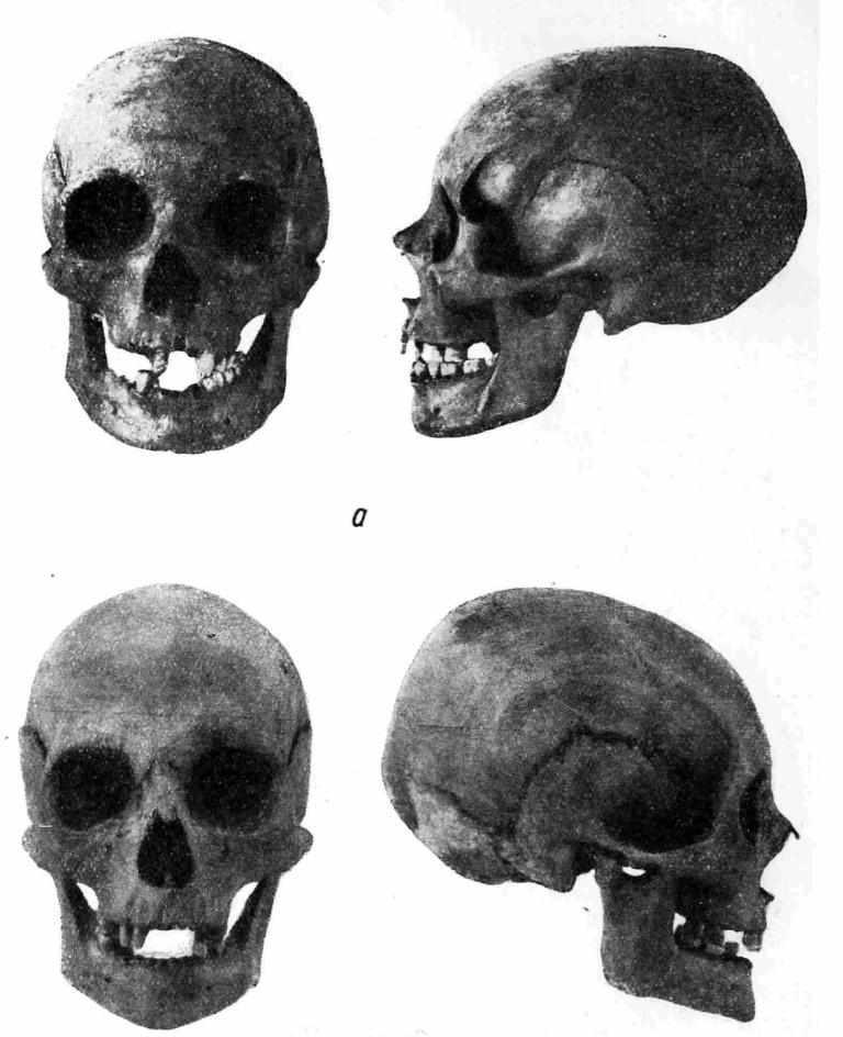 Рис. 17. а — череп Анны — первой жены Ярослава; 6 — череп Ингигерд — второй жены Ярослава.
