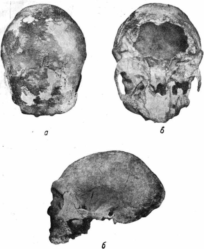 Рис. 30. Череп неандертальца, найденный в гроте на горе Чирчео.