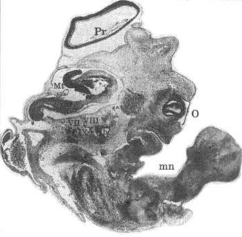 Рис. VIII. 1. Тотальный сагиттальный срез эмбриона человека, вероятный возраст 6-7 недель(окраска по Нисслю; увеличение 42,5:1). Срез проходит на уровне proeencephalon (Pr), metencephalon (Mt), надбровной дуги, лобной пазухи верхнего и нижнего век глаза (О), продольного разреза формирующейся руки (mn), а также на уровне целого пучка задних черепно-мозговых нервов (VII. VIII, IX. X). 