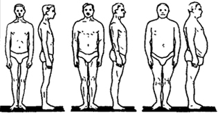 Рис. VII. 1. Основные типы телосложения мужчин (по схеме В.В. Бунака): 1 - грудной, 2 - мускульный, 3 - брюшной 