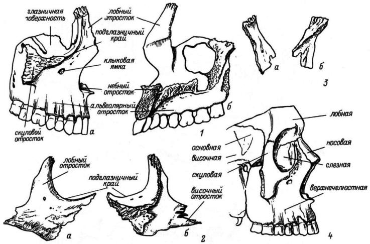 Рис. 6. Кости лицевого отдела. 1 — верхнечелюстная кость; 2 — скуловая кость; 3 — носовая кость; 4 — лицевой отдел черепа, вид снаружи. а — вид снаружи; б — вид изнутри.
