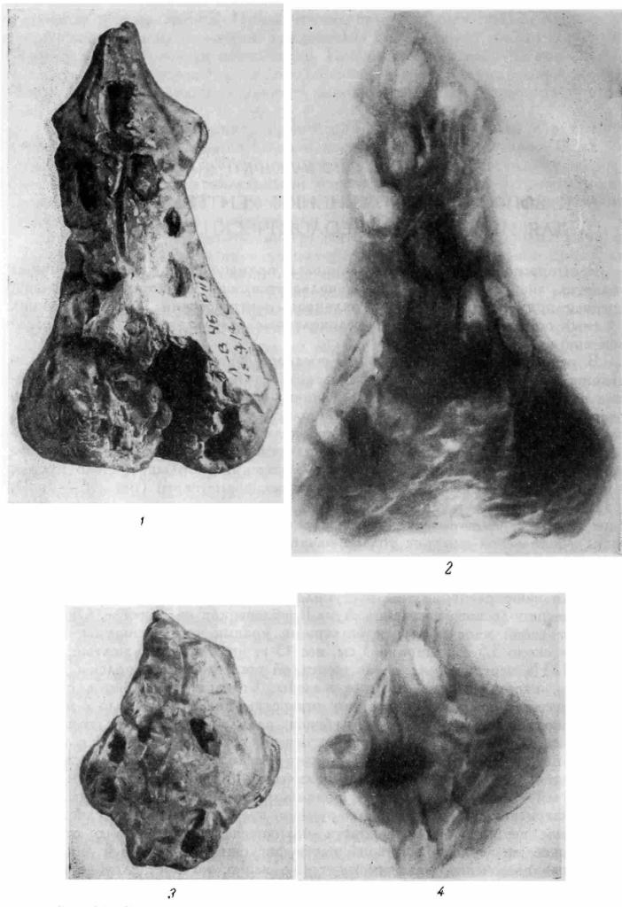 Рис. 56. Фотографические и рентгеновские снимки статуэток с оттисками зерен.