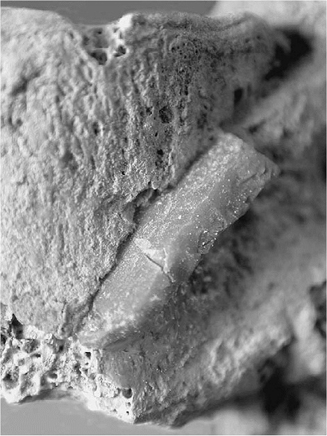Грудной позвонок позднепалеолитического человека из пещеры Кебара в Израиле с застрявшим в нем обломком каменного наконечника