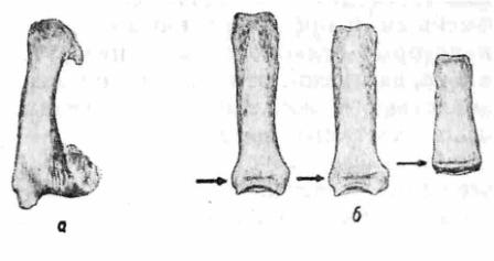 Рис. 8. а — первая правая пястная кость Ярослава Мудрого. Старый сросшийся внутрисуставной перелом в области основания пястной ости. Мощные вторичные костные разрастания. Объем движений в этом суставе был ограничен. В области головки этой кости видны краевые костные разрастания, возникшие в результате хронической перегрузки; 6 — короткие трубчатые кости Ярослава (две основные и одна средняя фаланга). Отсутствие проявлений старения. Сохранение поперечной пластинки (поперечный „тяж" отмечен стрелкой) в области бывших зон роста как косвенное проявление некоторого субгенитализма.